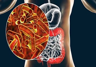Dibujo de las bacterias que provocan la enfermedad de la Shigelosis, que afecta al cuadro gastrointestinal de las personas infectadas