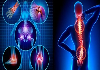 Dibujo que muestra las zonas del cuerpo donde es más habitual sufrir dolores crónicos