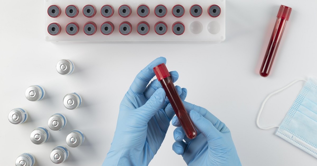 Aparecen tubos con sangre, de una extracción. Analizando una enfermedad hematológica.