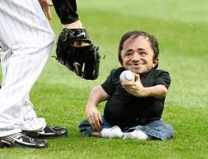 Una persona afectada de Osteogénesis Imperfecta