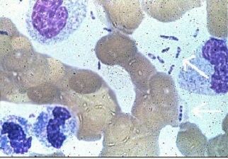 Mancha de sangre que contiene la bacteria de la peste y tienen forma de alfiler