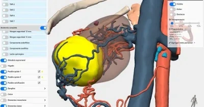 modelo 3d renal con la ayuda de la IA