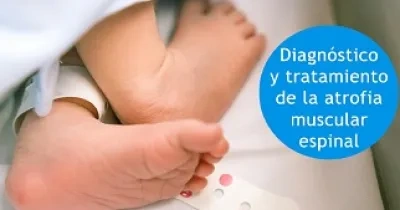Banner sobre el diagnostico y tratamiento de la atrofia muscular espinal, con los pies de un bebé en su cuna (Fuente: Guía Infantil S.L.)