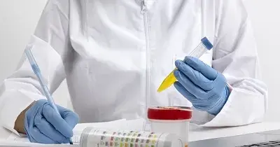 imagen analizando una muestra de orina