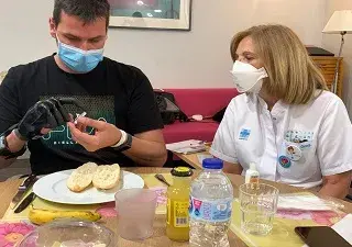 Paciente usando la mano biónica parcial multiarticulada