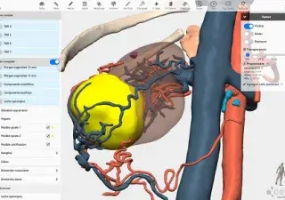 modelo 3d renal con la ayuda de la IA