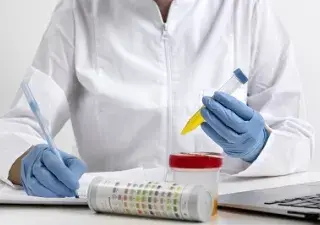imagen analizando una muestra de orina