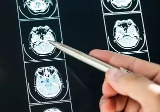 Una exploración médica del cerebro (Fuente: Freepik)